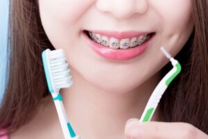 interdental-brushes-for-braces